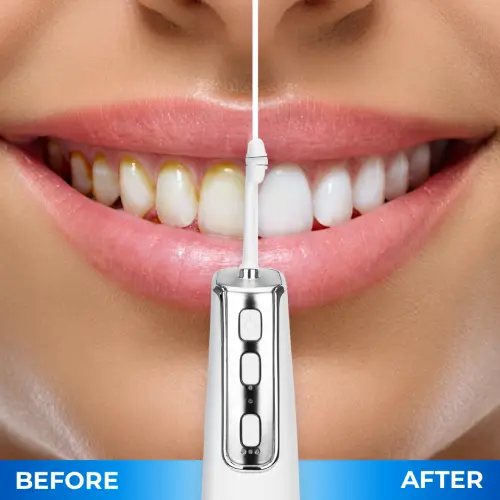 Miracle Smile Magic Flosser Benefits