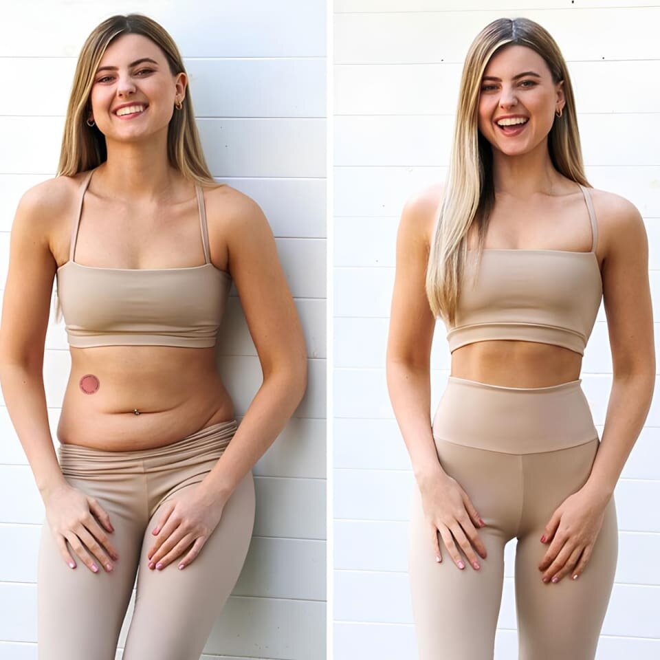 NuraPatch-GLP-1-Patches-Benefits